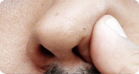 Choked / Blocked Nose,asthma , sneezing, allergy doctor, mp indore india