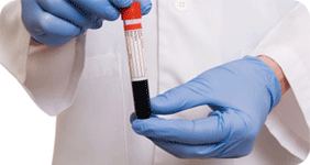 blood, blood allergy test, Serum Allergy Test, allergy test machine, blood allergy test in indore, bhopal, gwalior, ujjain, khargone and india