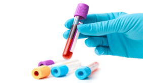 blood allergy test, blood, blood allergy, test for allergy, serum test, serum allergy test allergy, allergy test , skin, skin allergy, skin allergy test, skin allergy test method
