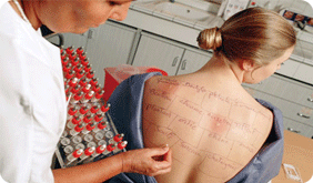 skin allergy test, allergy test, allergy doctor in indore, indore, bhopal, india, Skin Prick method, allergy test method